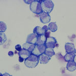 Towards an endless supply of human blood Towards an endless supply of human blood