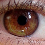 First transplant of reprogrammed stem cells from another person