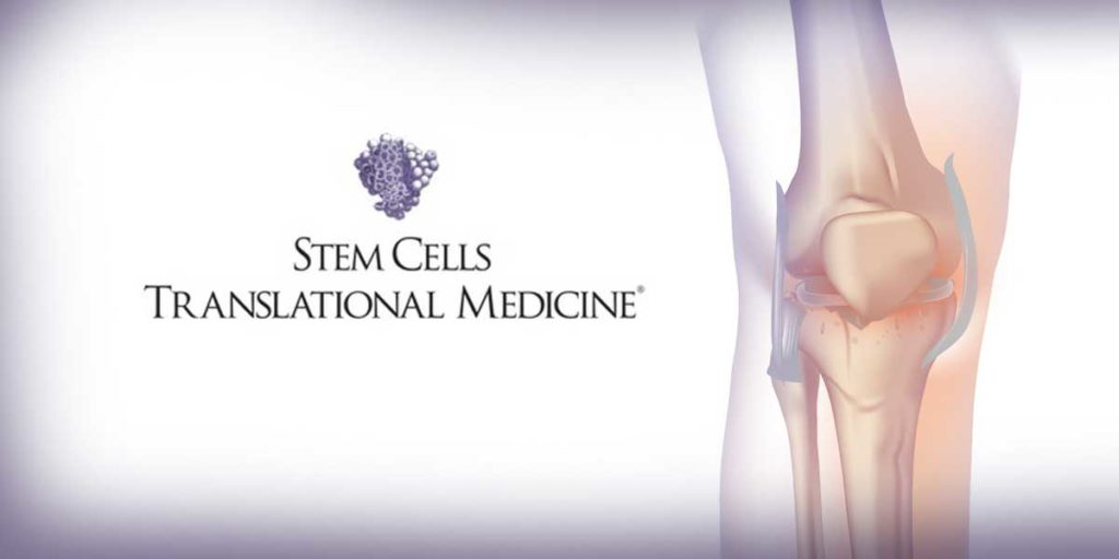 Clinical Trial Shows Promise Of Stem Cells In Offering Safe Effective Relief From Arthritic 