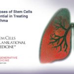 Multiple Doses of Stem Cells Show Potential in Treating Severe Asthma Multiple Doses of Stem Cells Show Potential in Treating Severe Asthma