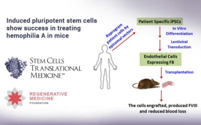 Induced pluripotent stem cells show success in treating hemophilia A in mice