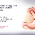 Stem cell-combo therapy could bring long-term relief for gastroparesis