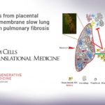 Stem cells from placental amniotic membrane slow lung scarring in pulmonary fibrosis Stem cells from placental amniotic membrane slow lung scarring in pulmonary fibrosis