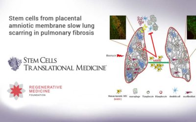 Stem cells from placental amniotic membrane slow lung scarring in pulmonary fibrosis