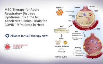 MSC Therapy for Acute Respiratory Distress Syndrome; It’s Time to Accelerate Clinical Trials for COVID-19 Patients in Need