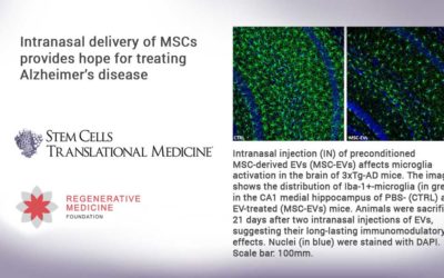 Intranasal delivery of MSCs provides hope for treating Alzheimer’s disease