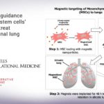 Magnetic guidance improves stem cells’ ability to treat occupational lung disease