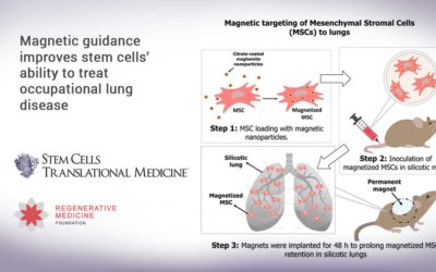 Magnetic guidance improves stem cells’ ability to treat occupational lung disease