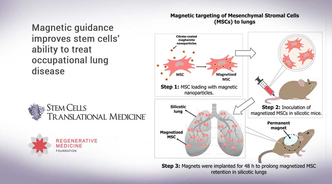 Magnetic guidance improves stem cells’ ability to treat occupational lung disease