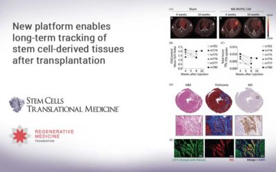 New platform enables long-term tracking of stem cell-derived tissues after transplantation