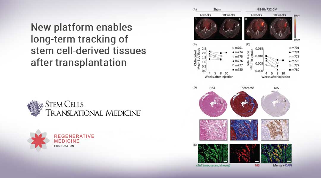 New platform enables long-term tracking of stem cell-derived tissues after transplantation