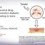 Adult stem cells/glaucoma drug combo promotes diabetic wound healing in mice