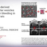 Stem cell-derived extracellular vesicles ease brain bleeding in newborn rats
