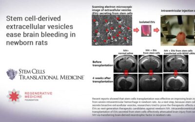 Stem cell-derived extracellular vesicles ease brain bleeding in newborn rats