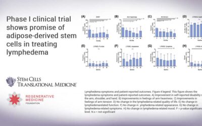 Phase I clinical trial shows promise of adipose-derived stem cells in treating lymphedema