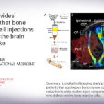 Study provides evidence that bone marrow cell injections help heal the brain after stroke Study provides evidence that bone marrow cell injections help heal the brain after stroke