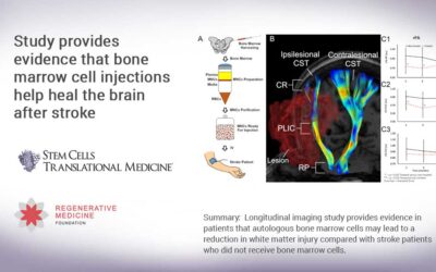 Study provides evidence that bone marrow cell injections help heal the brain after stroke