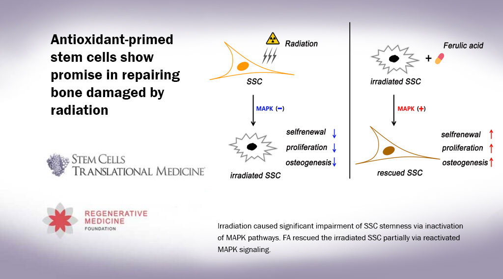 Antioxidant-primed stem cells show promise in repairing bone damaged by radiation