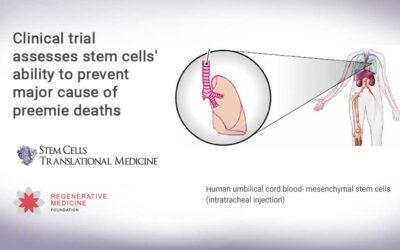 Clinical trial assesses stem cells’ ability to prevent major cause of preemie deaths