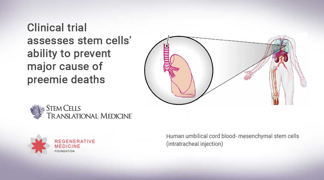 Clinical trial assesses stem cells’ ability to prevent major cause of preemie deaths