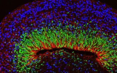 Scientists develop brain organoids with complex neural activity