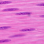 New Hope for Muscle-Related Diseases? Converting skin cells to immature muscle cells spurs changes, study finds