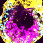 What’s next for lab-grown human embryos? What’s next for lab-grown human embryos?