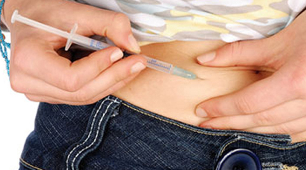 Type 1 Diabetes Trial Tests Insulin-Secreting Implants Derived from Stem Cells