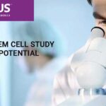 Stem Cell Therapy Shows Early Promise for the Treatment of Lupus