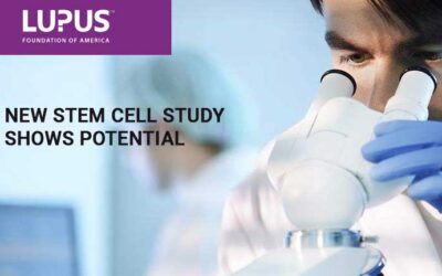 Stem Cell Therapy Shows Early Promise for the Treatment of Lupus