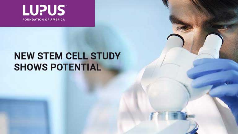 Stem Cell Therapy Shows Early Promise for the Treatment of Lupus