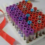 Researchers report third case of HIV remission after stem cell transplant using umbilical cord blood Researchers report third case of HIV remission after stem cell transplant using umbilical cord blood