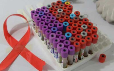 Researchers report third case of HIV remission after stem cell transplant using umbilical cord blood