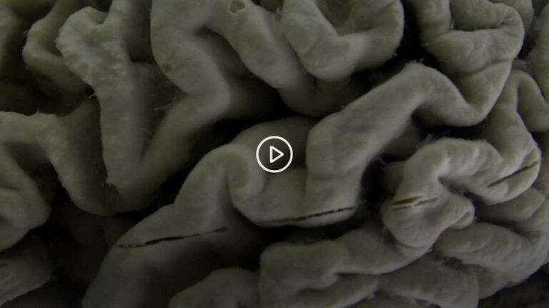 Scientists make key discovery in fighting brain diseases