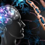 Stem cell therapy to slow progression of multiple sclerosis (MS) Stem cell therapy to slow progression of multiple sclerosis (MS)