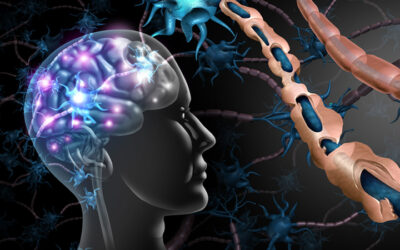Stem cell therapy to slow progression of multiple sclerosis (MS)