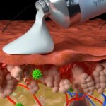 ‘Super Melanin’ Heals Skin Injuries From Sunburn, Chemical Burns