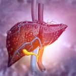 Macrophage cell therapy: a new hope for chronic liver disease patients