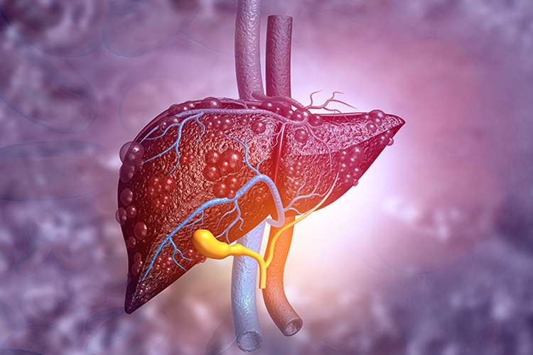 Macrophage cell therapy: a new hope for chronic liver disease patients