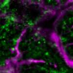 New Gene Therapy Reverses Heart Failure in Large Animal Model